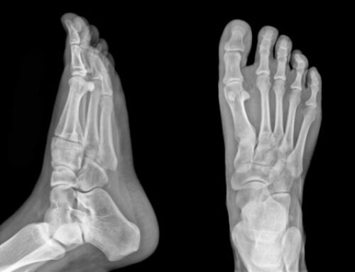 How Long Does an X-Rays take?