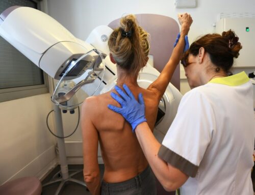 All About OBSP Mammography