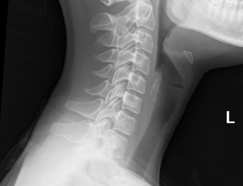 All about Neck X-ray 